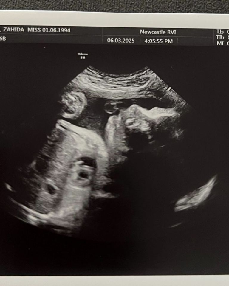 Ultrasound image of a fetus.