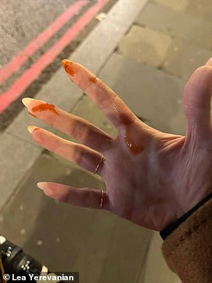 Ms Yerevanian told MailOnline how she was left feeling 'violated' after thieves sprayed her with ketchup in a bid to distract her while they took her belongings. Pictured: Ketchup left on Ms Yerevanian's hand