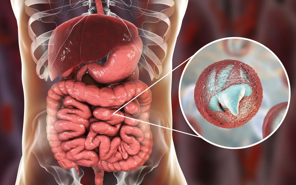 Illustration of Cryptosporidium parvum in the human intestine.