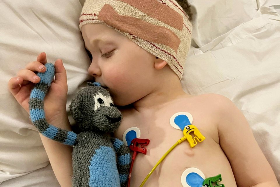 A three-year-old boy sleeping in a hospital bed with medical equipment attached to his chest, holding a knitted monkey.
