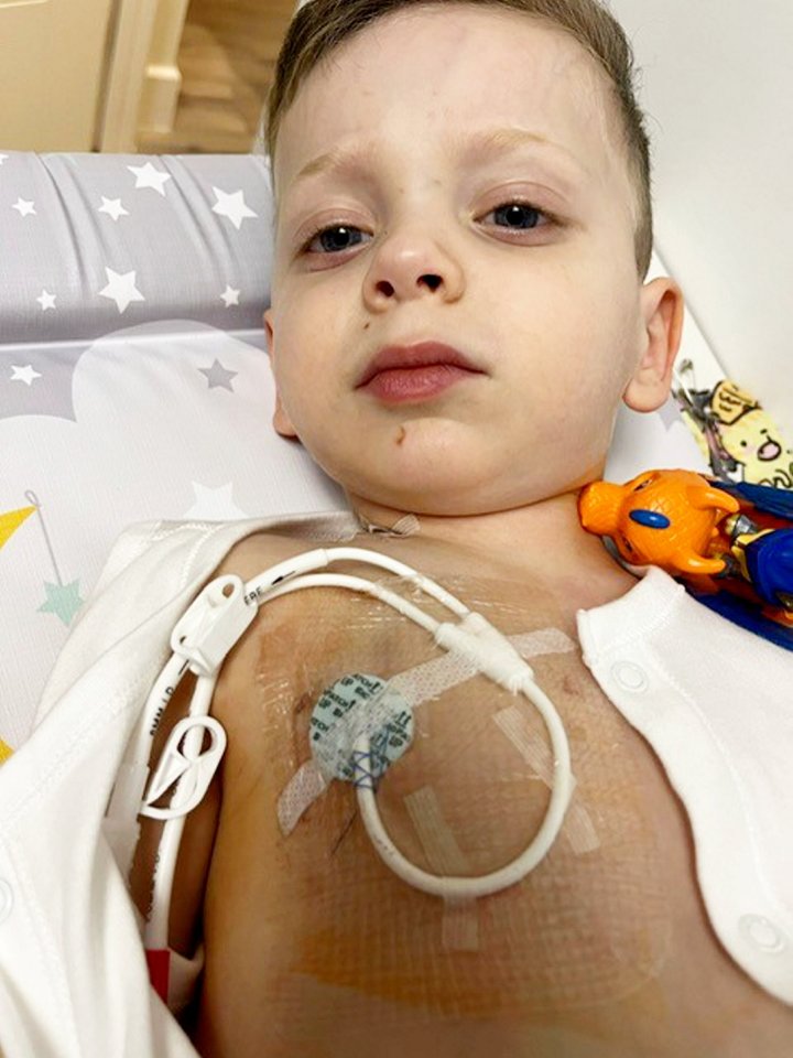 Three-year-old boy with medical tubes attached to his chest.