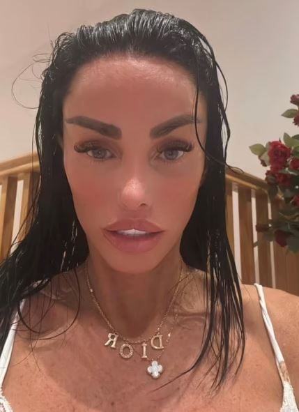 Close-up of Katie Price, showing a taut visage and dramatic weight loss.