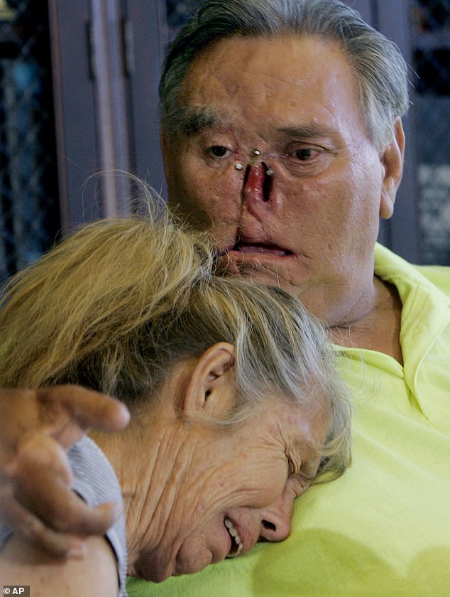 LaDonna, left, and St James Davis, lost body parts in a frenzied chimpanzee attack in 2005 and were seen sobbing when their 'son' disappeared, never to be seen again