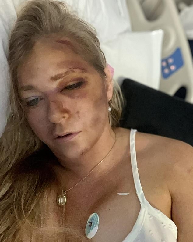In recent weeks, she had made troubling posts on social media - including a spate of hospital admissions, a quad bike accident and her claims she had 'four days to live'