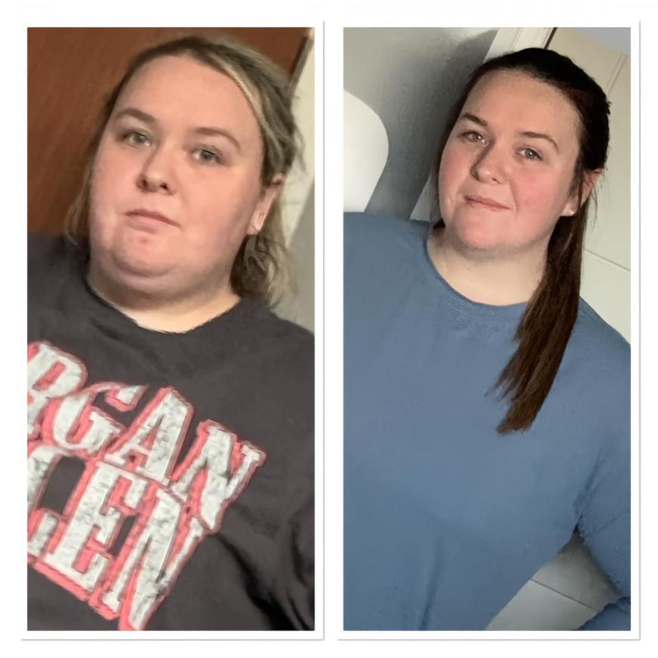 Before and after photos showing a woman's weight loss.