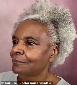 For her first round of surgery, Linda stayed awake and she said she felt very little pain