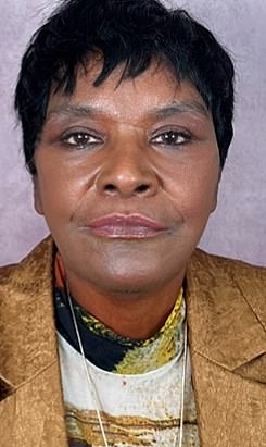 In a YouTube video, Linda is seen as she undergoes a nine-month transformation with a full facelift