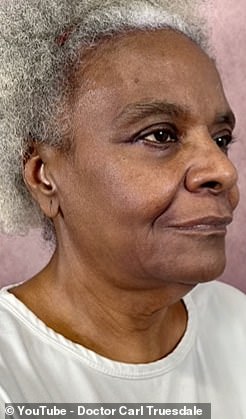 Linda Truesdale was 68 years old when she decided she wanted to get a facelift