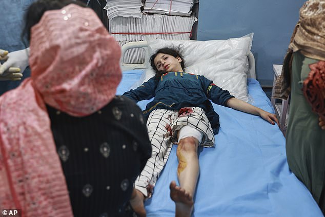 A girl who lives in a village near the Line of control between India and Pakistan, and got injured during shelling by Pakistan gets treated at a hospital in Uri, Indian controlled Kashmir, Wednesday, May 7, 2025