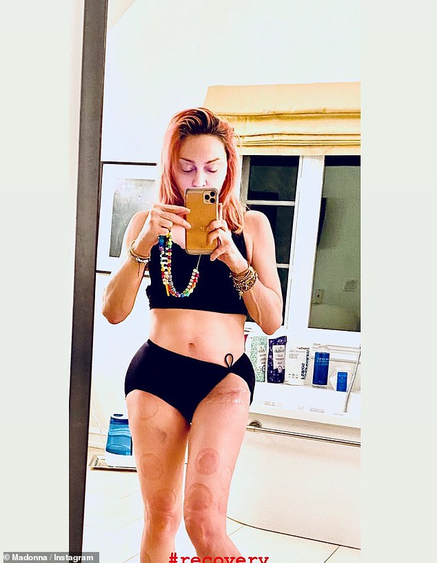 It's unclear what Madonna's specific use for the device is, though it's possible she is using it to aid in recovery or manage pain related to her 2020 hip replacement surgery and a significant knee injury sustained that same year