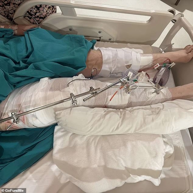 Five hours after the fall, Liam reached a local hospital where they rushed him into emergency surgery for three major operations, multiple blood transfusions and gave him antibiotics