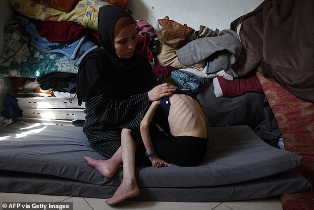 Shuruq Ayyad shows off the protruding ribs of her 12-year-old daughter Rahaf at a school-turned-shelter in al-Rimal in central Gaza City on May 4, 2025