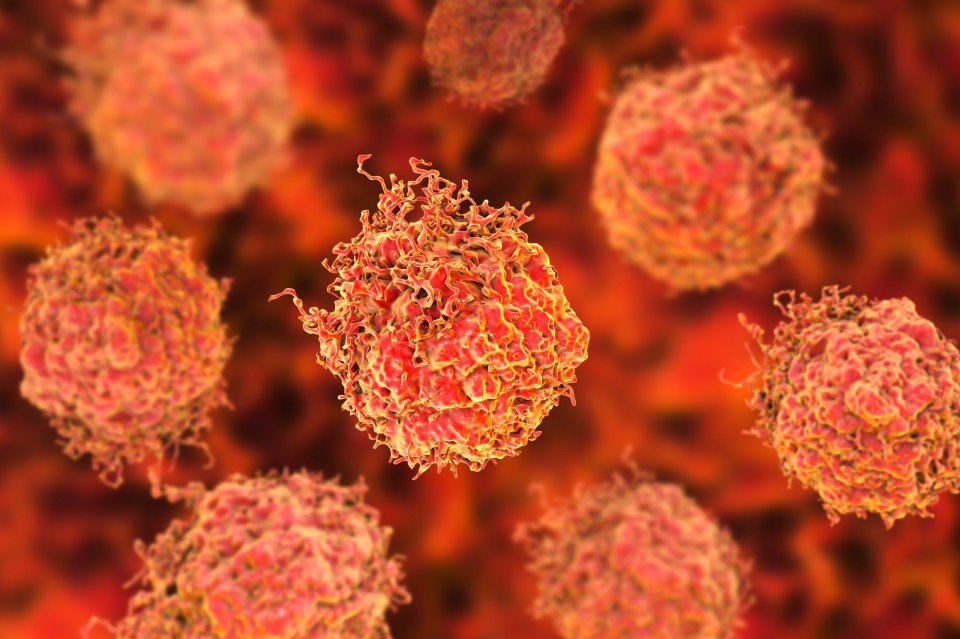3D illustration of prostate cancer cells.