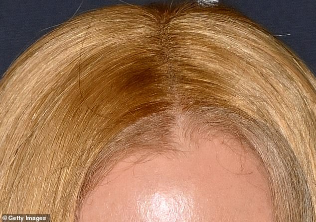 However, the mesh wig cap was visible as Nicole posed for photos on the red carpet despite her real hair being weaved into it