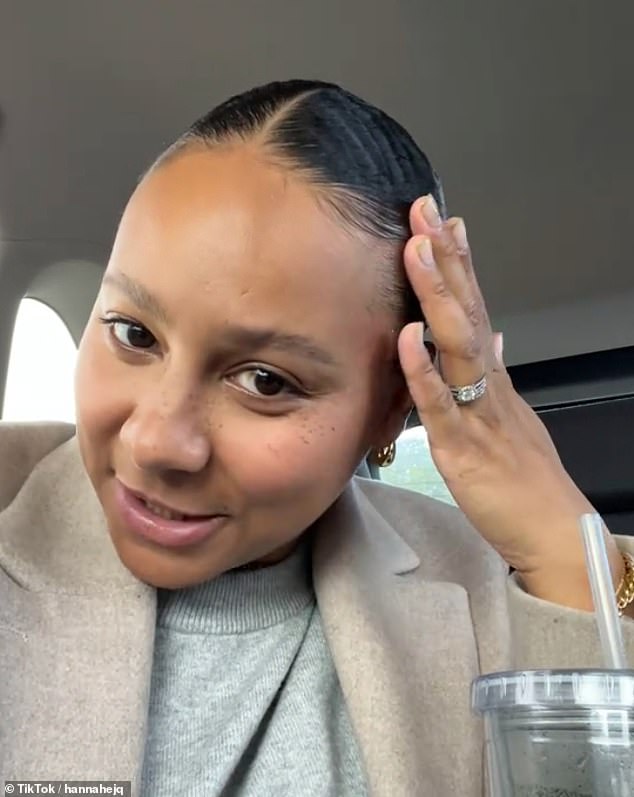 TikToker Hannah expressed her concerns about the slicked back bun showing her hair loss, especially after having a baby