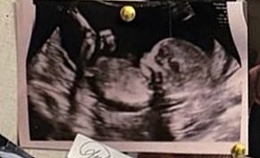These amateur sleuths also claim that even the ultrasound picture doesn¿t wash, as there is no ¿hospital name, reference number, date or ID¿