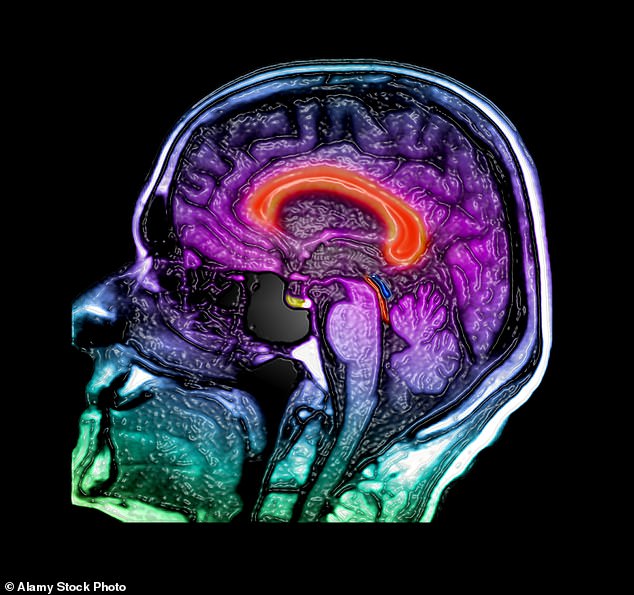 The condition can be treated by inserting a device to gradually drain fluid from the brain