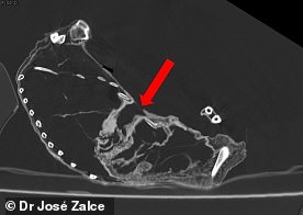 CT scans of Montserrat (pictured) indicated she likely died from a puncture wound to the chest, specifically between the fifth and sixth ribs