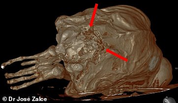 The team also described a zigzag-shaped wound with a broken pattern, suggesting that Maria may have fallen from a cliff and hit rocks during the fall