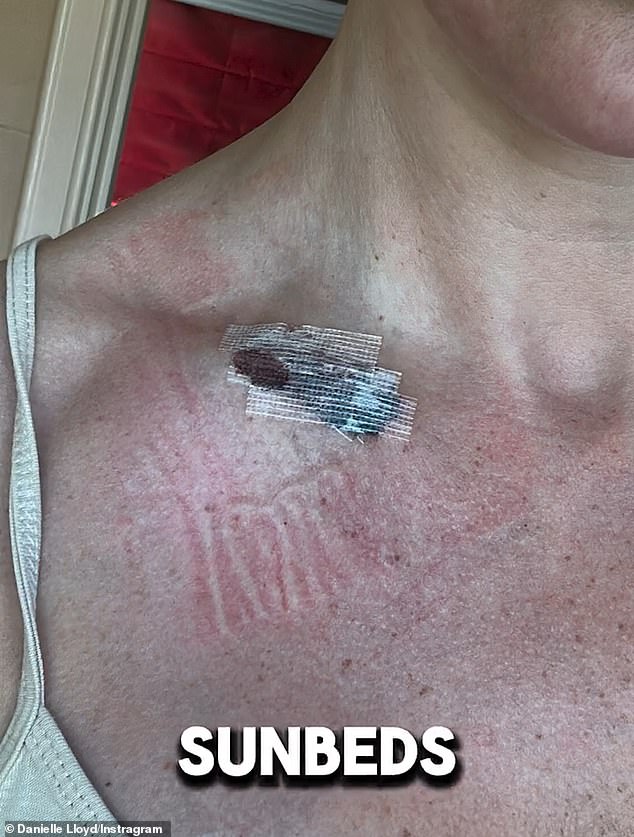Danielle's ordeal began last spring when she noticed that a mole on her collarbone was changing shape