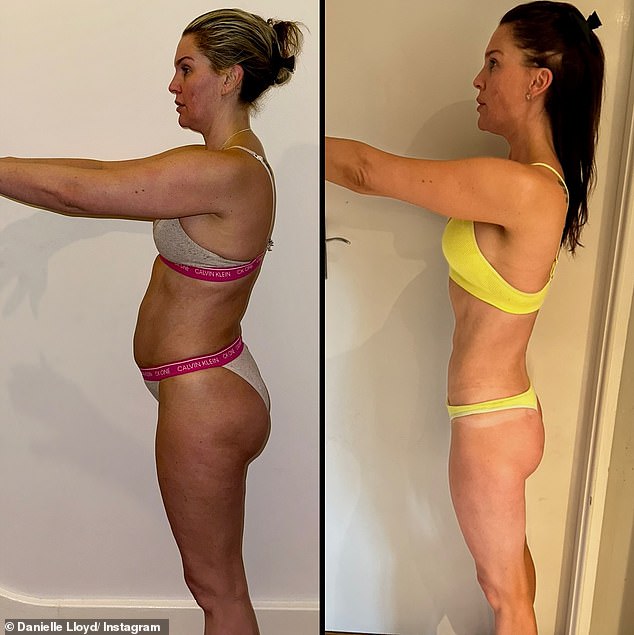 Danielle, who is now cancer free, took to her Instagram on Sunday with before and after snaps of herself in underwear and showed off her shrinking frame