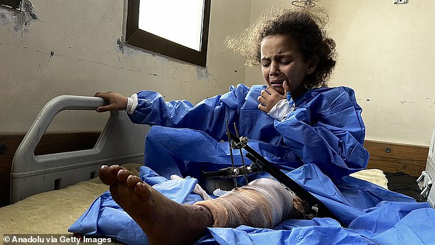 Sila Madi, who is eight years old, lies in a hospital bed as she receives treatment after an Israeli attack at Nasser Hospital in Khan Yunis on May 26. As a result of the attack, Sila's right leg was amputated and her left leg is at risk of amputation