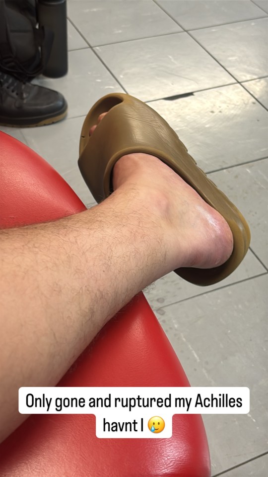 Person's injured ankle and text overlay: "Only gone and ruptured my Achilles havnt I"