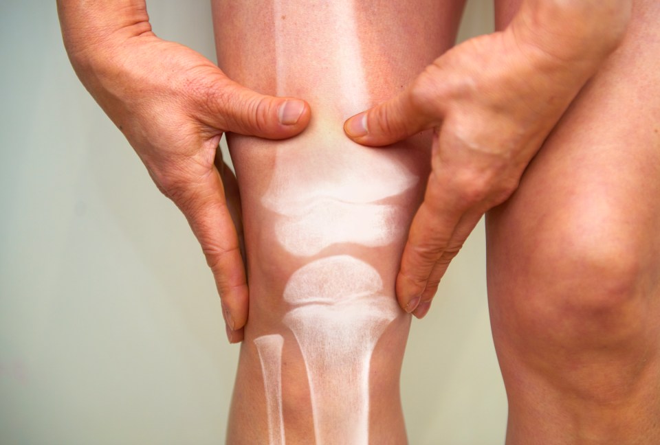 Person's hands on a knee with an overlay of a visible x-ray showing the bones.