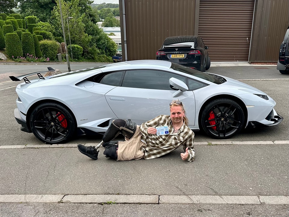 Man with prosthetic leg lying next to his Lamborghini, holding a parking ticket.