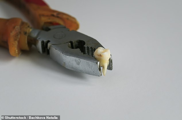 More than a quarter of Britons unable to access an NHS dentist have resorted to DIY treatments such as pulling their teeth out with pliers, an alarming study reveals
