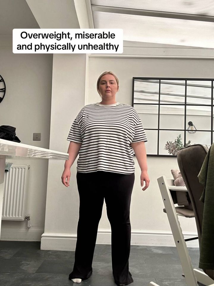 Before and after photo of a woman who lost weight.