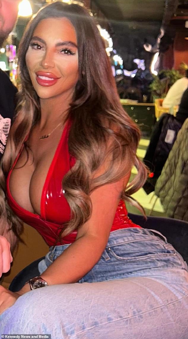 Last year Monique Sofroniou (pictured), 30, called for a ban on 'liquid BBLs' after a botched procedure left her buttocks with leaking black holes and in pain 'worse than childbirth'