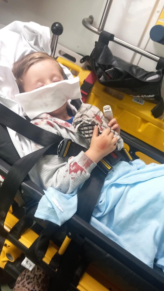 A young boy with blood on his face and clothing lies on a stretcher in an ambulance.