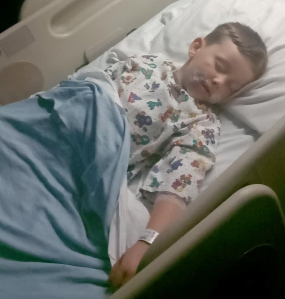 Four-year-old boy sleeping in a hospital bed with injuries.