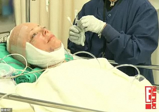 Though Kris has not specified what work she's had done with Dr. Levine, it wouldn't mark her first time going under the knife. In 2011, a terrified Kris was filmed being wheeled in for a facelift on her reality show, Keeping Up With The Kardashians