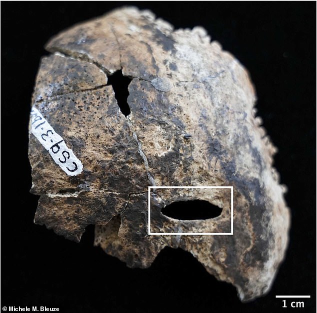 This image shows a lesion on an occipital bone ¿ the bone at the lower back of the skull ¿ recovered from the cave