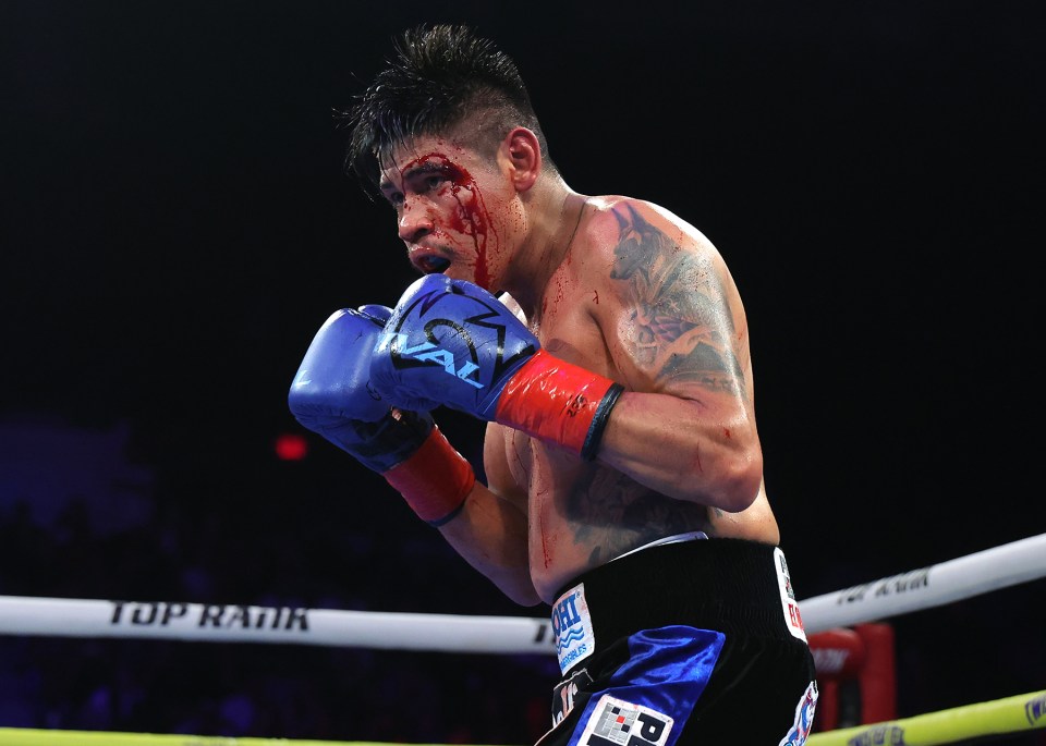 A bloody boxer in a boxing ring.