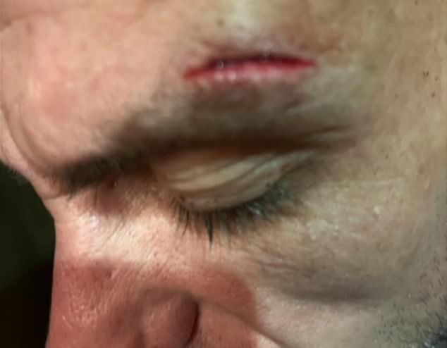 Keeran Rolls (pictured) has vowed to never return to the country after the 32-year-old from Gedling alleged he was punched both in the toilets and in front of his young children