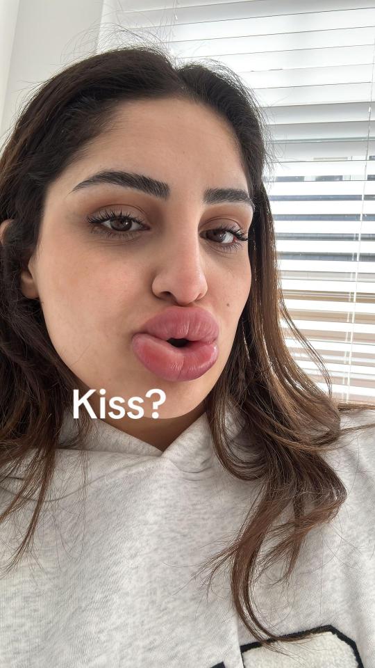 Close-up selfie of a woman puckering her lips, with the text "Kiss?" overlaid.