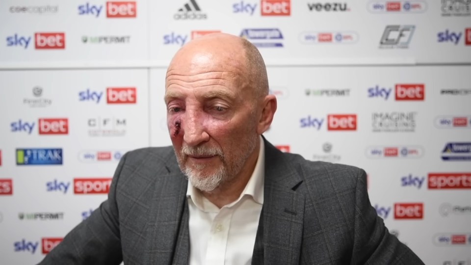 Man with a bruise on his face.