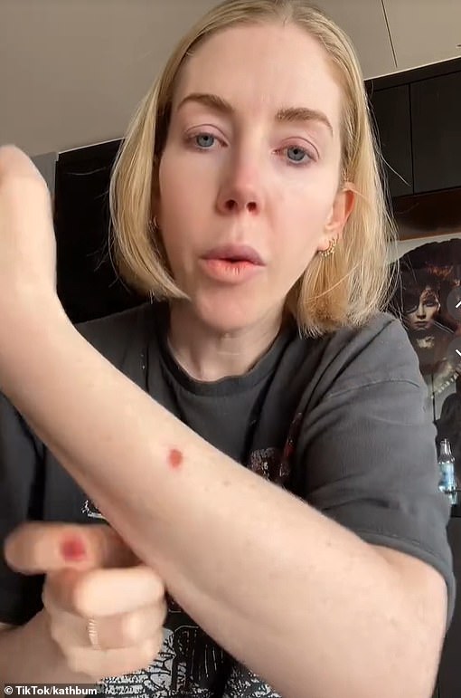 Just last month Katherine revealed she's battling skin cancer. She made the revelation in her podcast, Telling Everybody Everythin g, explaining that she paid to have mole removed