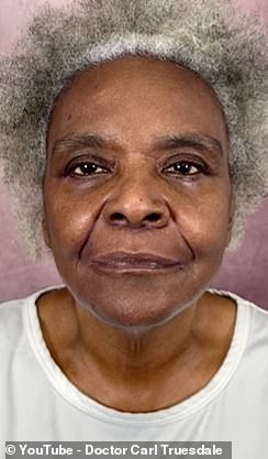 Linda Truesdale was 68 years old when she decided she wanted to get a facelift