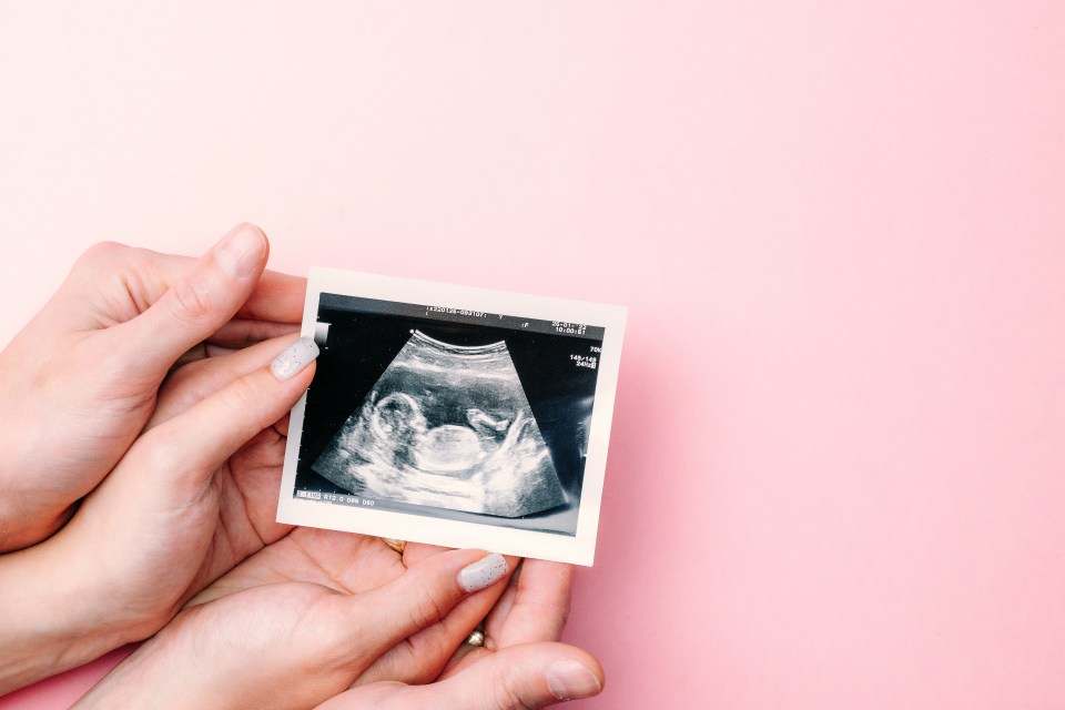Couple holding ultrasound image of their baby.