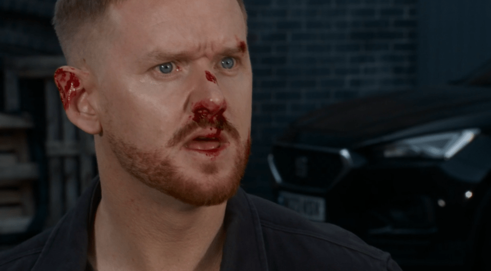 Man with bloody injuries to his face and ear.