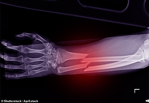 Up to 40 per cent of the weight people lose by using injections of GLP-1 agonists ¿ such as Ozempic, Wegovy and Mounjaro ¿ comes from their vital muscle and bone mass. Pictured: File photo