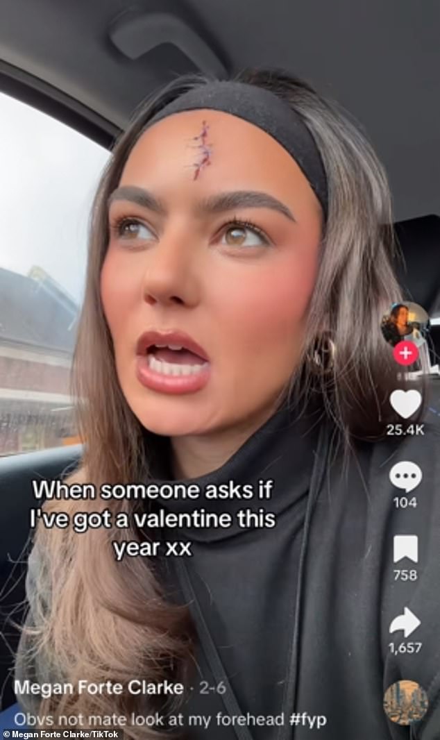 Megan has a distinguishing feature that won't go unnoticed, a Harry Potter-style lightning scar on her forehead, which she claims was a result of her 'slipping and falling down the stairs'