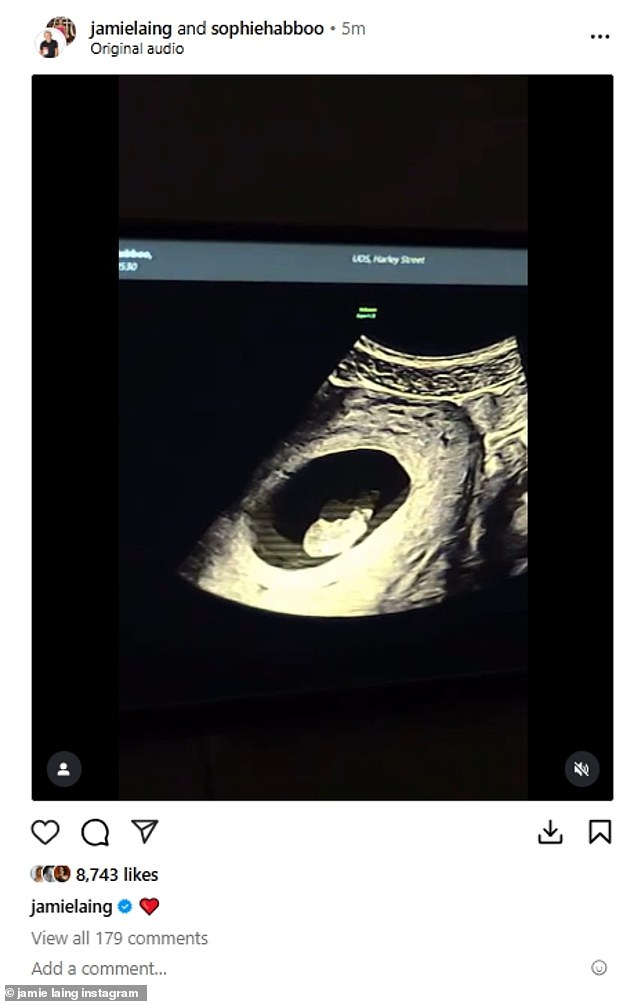 The sweet clip showed them having an ultrasound as Sophie looked delighted staring at the screen