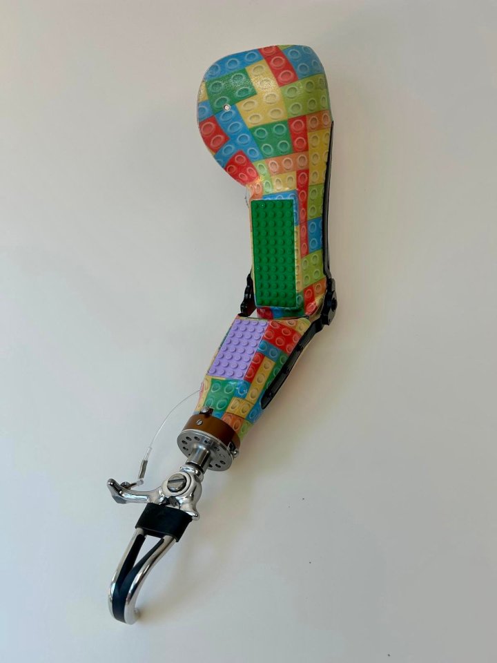 Lego-themed prosthetic arm for a child.
