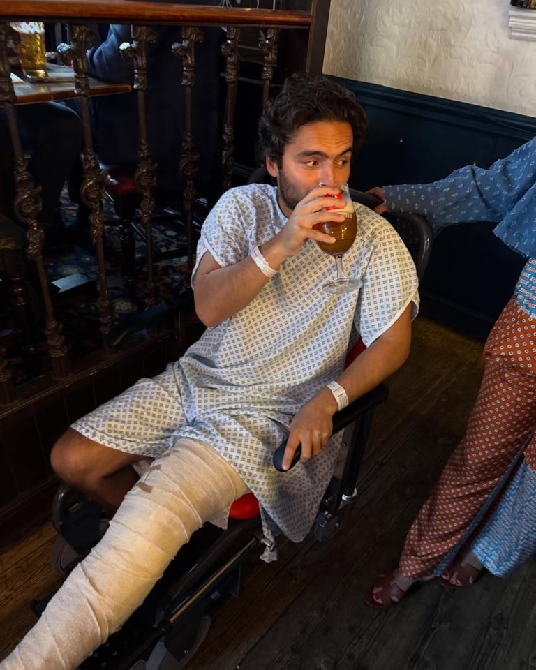 Man in hospital gown with leg cast drinking beer in a pub.