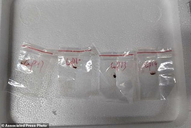 A pair of Chinese researchers have been charged in Michigan for allegedly smuggling a biological pathogen (pictured) into the US to study at the University of Michigan